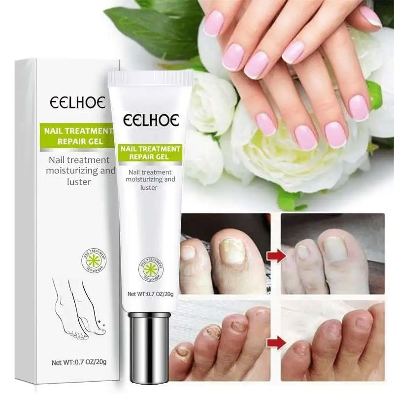 Nail Repair Gel Fungus Treatment Solution