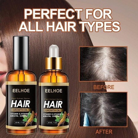 Hair essential oil bd